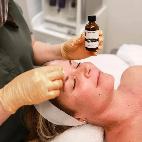 Professional skin peel treatment at Image London beauty salon